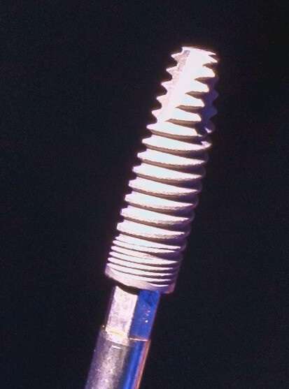 Dental_implant_macro_thread_Tafur_Dental_Clinic_Gibraltar