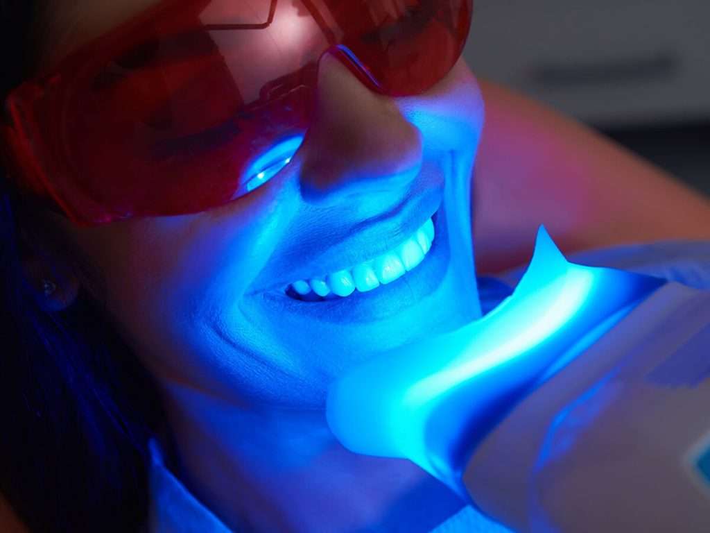 Blanqueamiento dental Málaga Philips