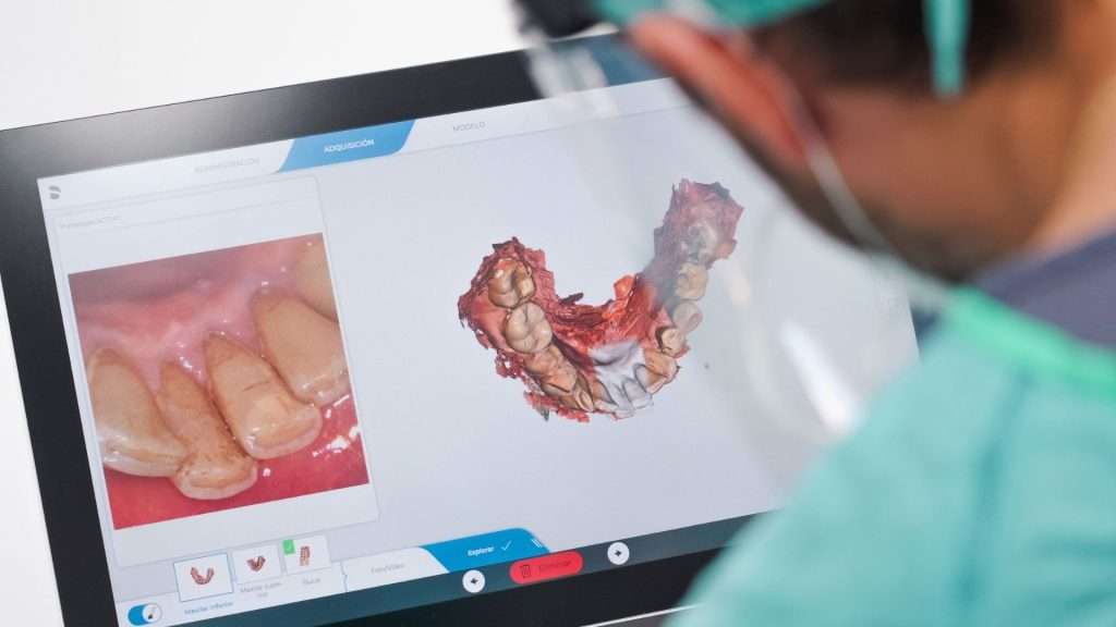 escaner intraoral Clinica Tafur Malaga